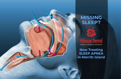 Dental Solutions for Obstructive Sleep Apnea - Hibiscus Dental